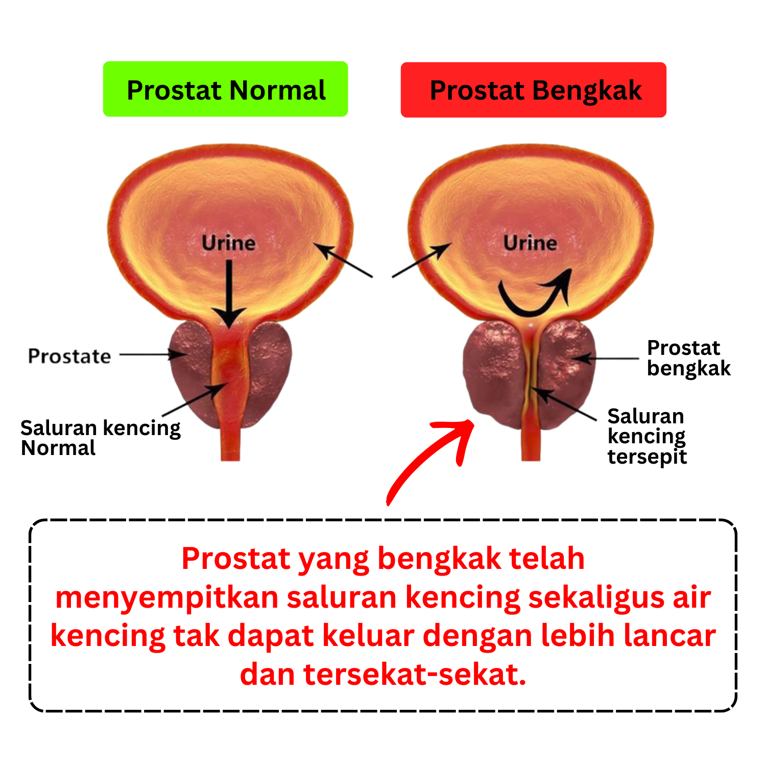 Anatomi Prostat